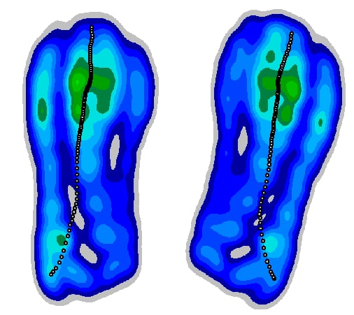 Muscle EMG and pressure data visualization